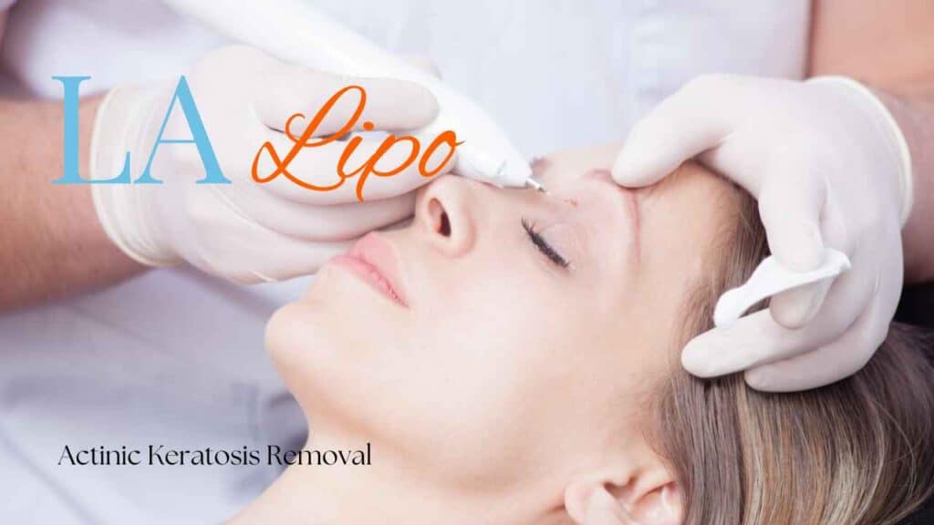 actinic keratosis removal Enfield Town