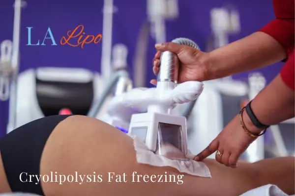 women getting fat freezing Enfield Town