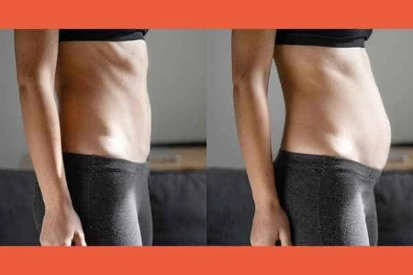 LA-EMS Body Sculpting results Enfield Town