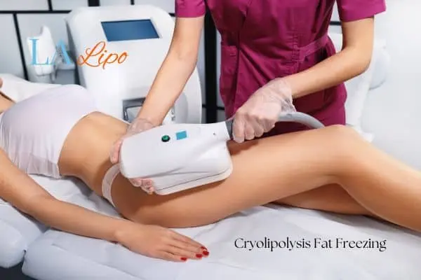 Woman receiving coolsculpting Enfield Town treatment on her thighs