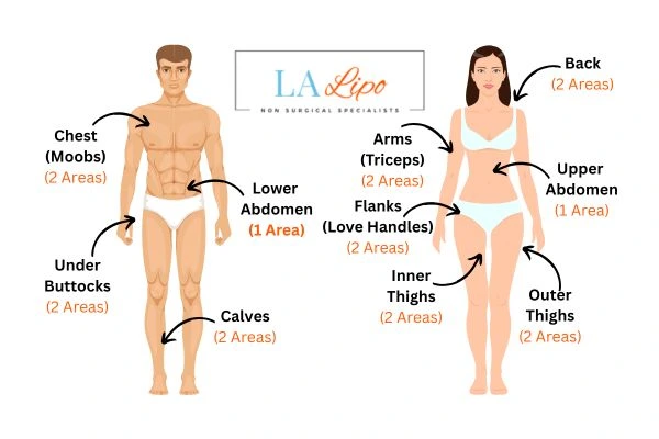 LA LIPO Cryolipolysis Areas Enfield Town