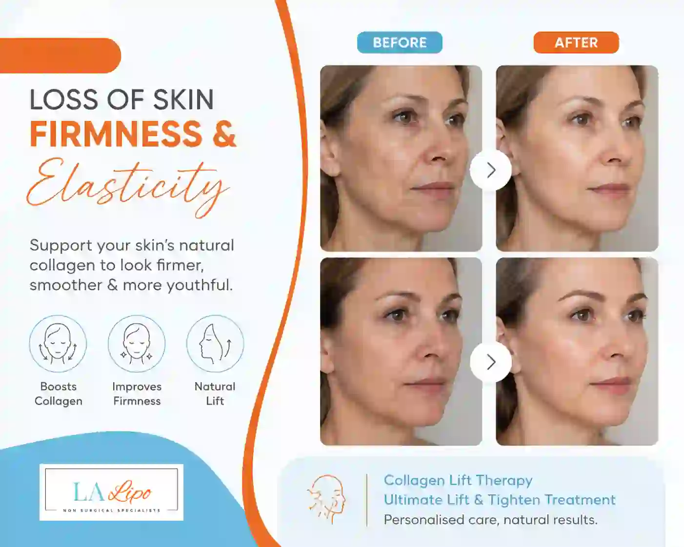 Sign #7: Loss of Skin Firmness and Elasticity Enfield Town